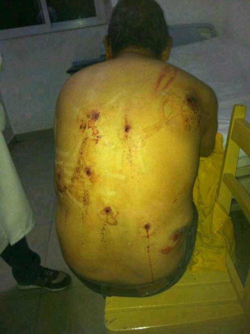 Urgyen Tashi from Dakchu camp suffered 8 bullet wounds